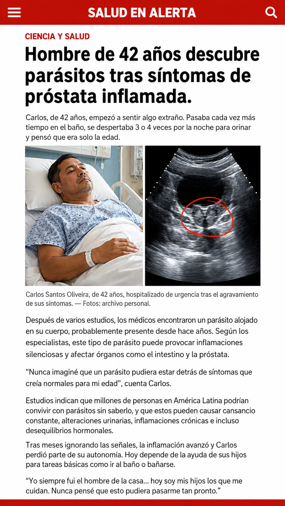 Noticia de Salud: Hombre de 42 años descubre parásito tras presentar síntomas de próstata agrandada